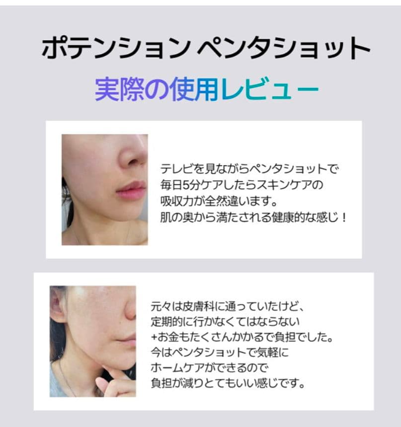 新品未開封☆セロラバイペンタショット4点セット☆美顔器 ポテンツァ