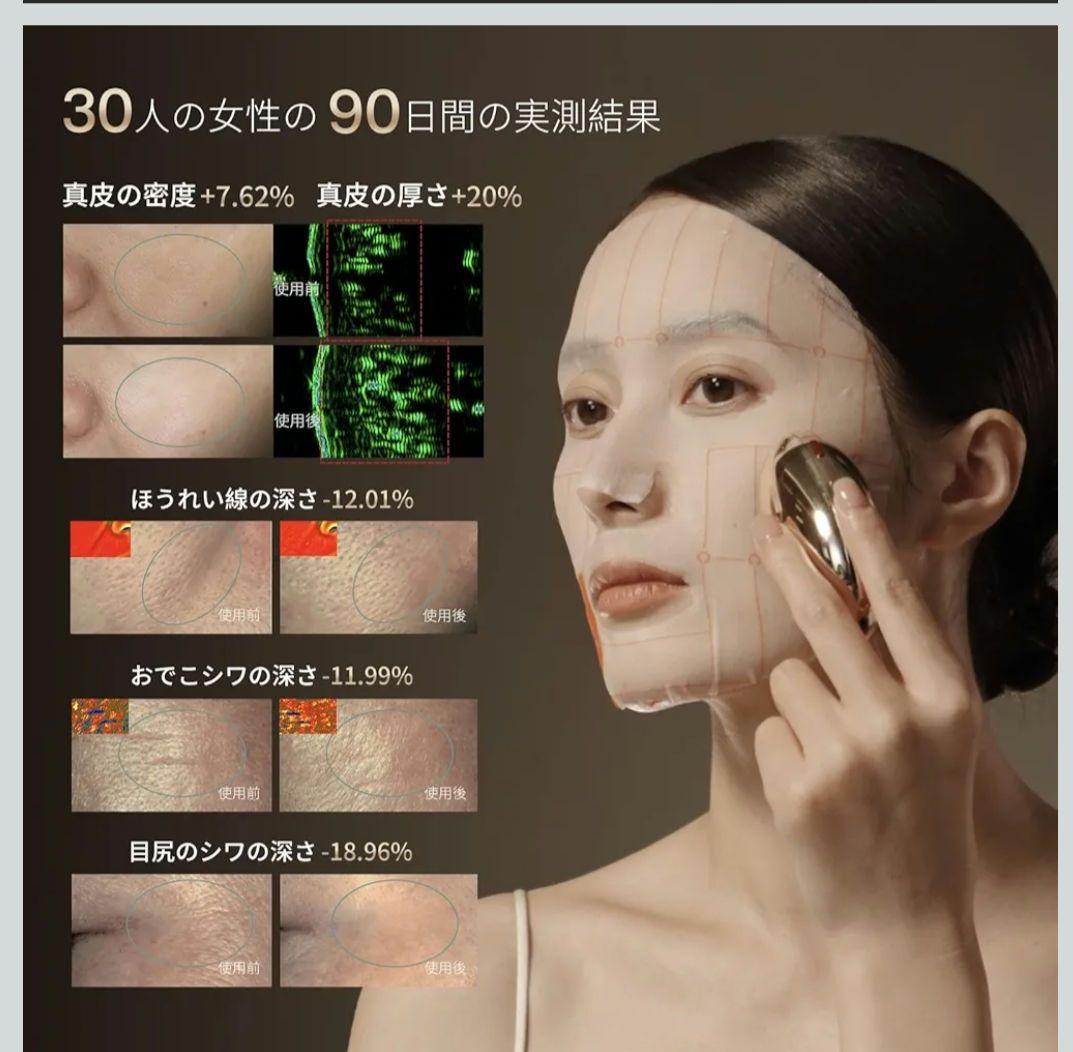 AMIRO 最新スタンプ式 RF美顔器 EMS搭載 肌引き締めリフトケア S1