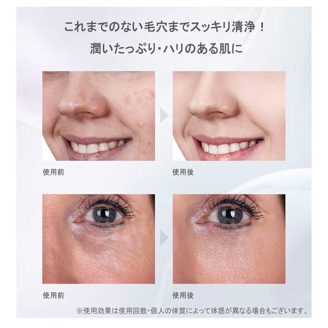 アクリアルピーリングプロEX 赤 2回使用 説明書なし